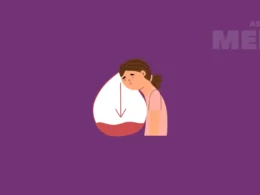 Anemia: Jenis, Gejala, dan Pengobatan